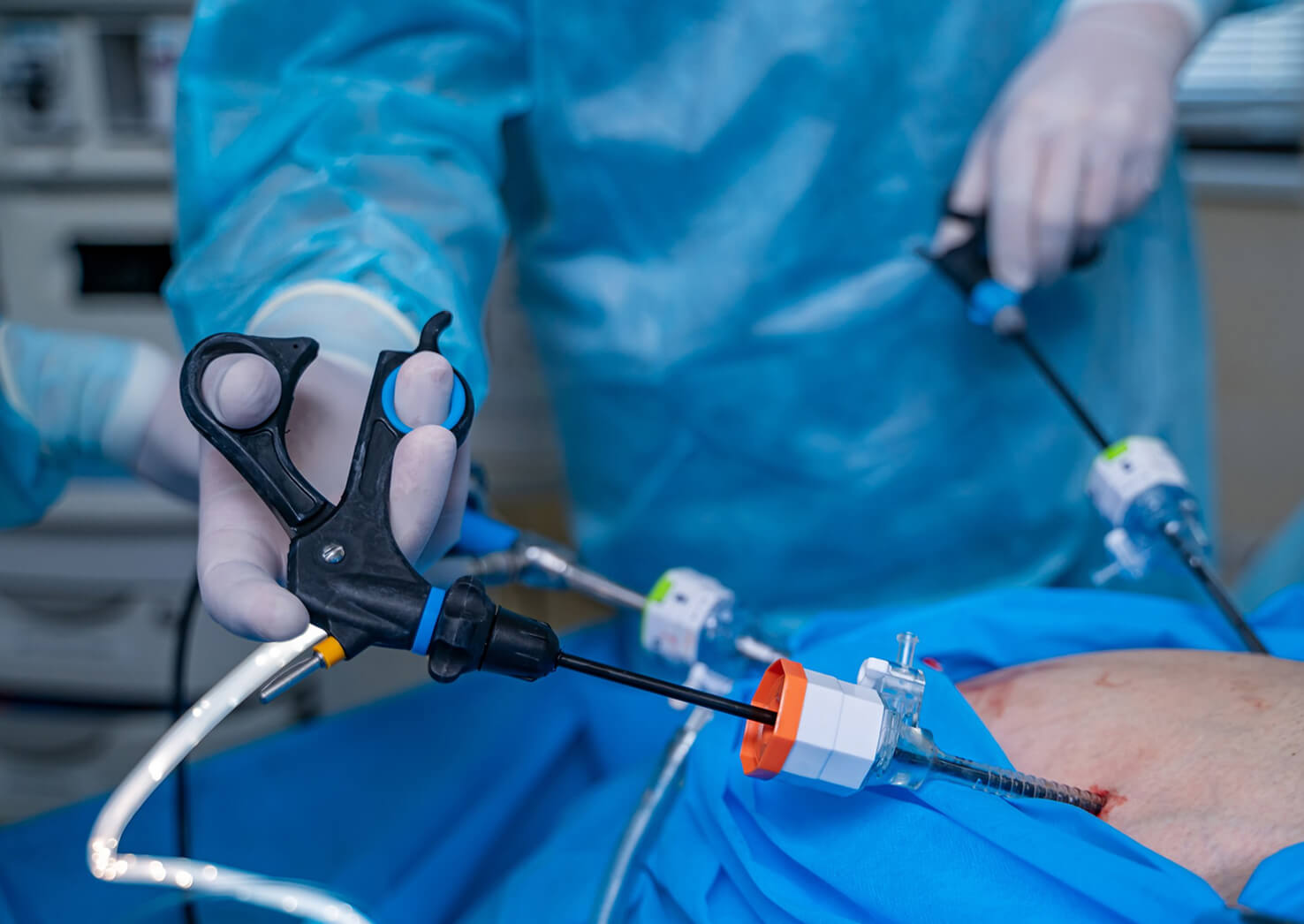 Cirurgia Minimamente Invasiva por Laparoscopia